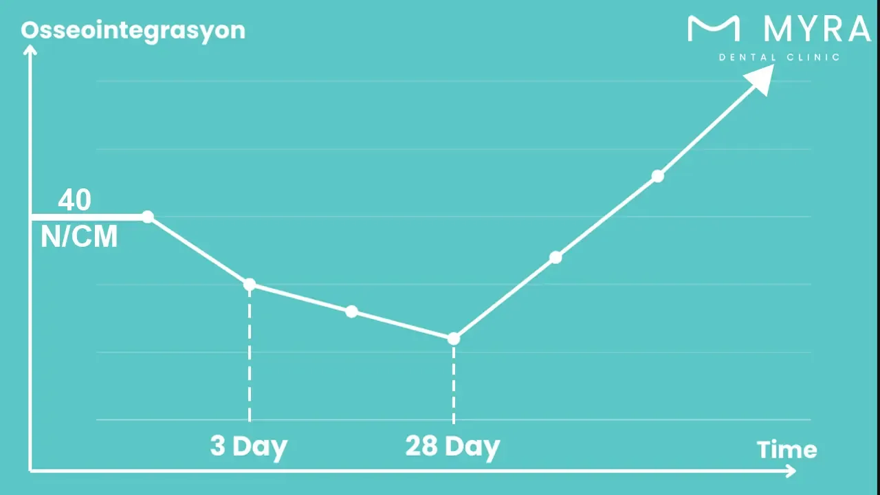 Healing and Integration Time for Dental Implant.webp